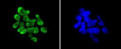 MSK1/RPS6KA5 Rabbit anti-Human, Rat, Clone: SN63-05, Novus Biologicals 100 &mu;L | Buy Online | Novus Biologicals | Fisher Scientific